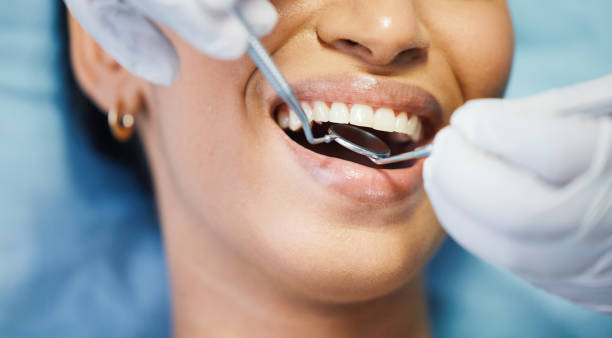 Best Broken Tooth Emergency  in Aberdeen, MS